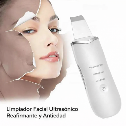 Espátula Ultrasónica Facial 4 Modos – Limpieza Profunda e Ionización