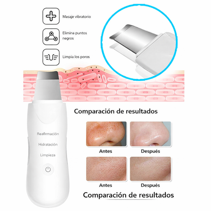 Espátula Ultrasónica Facial 4 Modos – Limpieza Profunda e Ionización